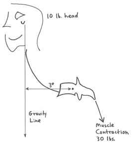 Forward Head Posture